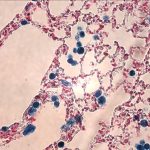 Lung 40x Pels